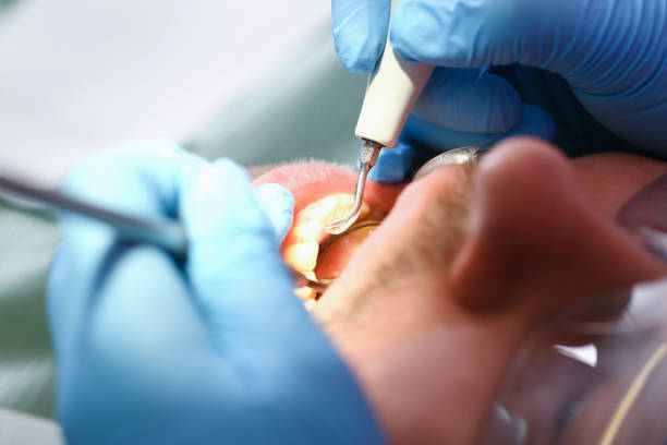 Best Pediatric Emergency Dentist in Albertson, NY