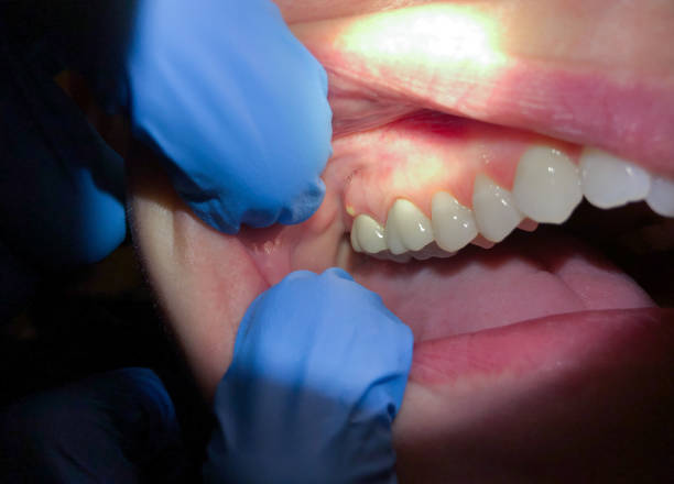 Best Orthodontic Emergency Dentist in Albertson, NY